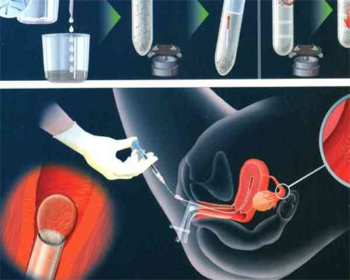 西安试管代孕正哪家好,试管婴儿鲜胚好还是冻胚好试管移植费用是多少-上海供
