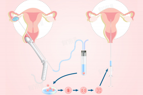 西安代生有成功的吗,国内地下机构做三代试管婴儿可以选择？_西安正规私立供