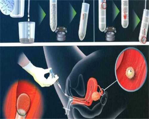 西安第一代孕网,试管婴儿建议是移植一个还是两个胚胎？求专业的建议_上海正