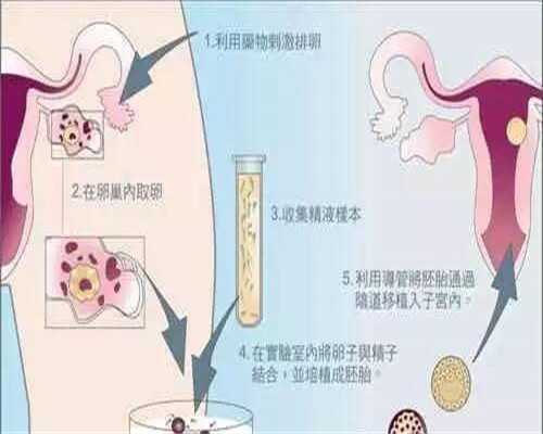陕西省人民医院?,2026陕西三代试管婴儿医院排名