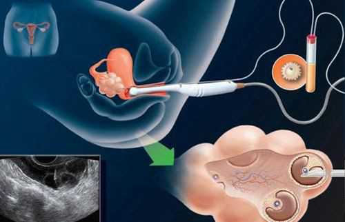 西安代孕哪家做得好,dna验血测性别几周最佳？亲身经历告诉你真相_西安地下供