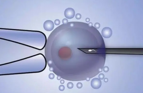 西安供卵包出生,美国试管婴儿冻胚移植后，着床过程是怎样的？-西安供卵试管