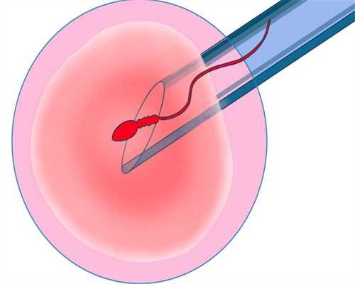 西安最靠谱代孕中心,第三代试管婴儿的费用贵吗？贵在什么地方？-西安供卵试