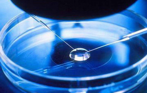 供卵试管婴儿全部流程&精子分离术,治疗不孕不育别乱求医