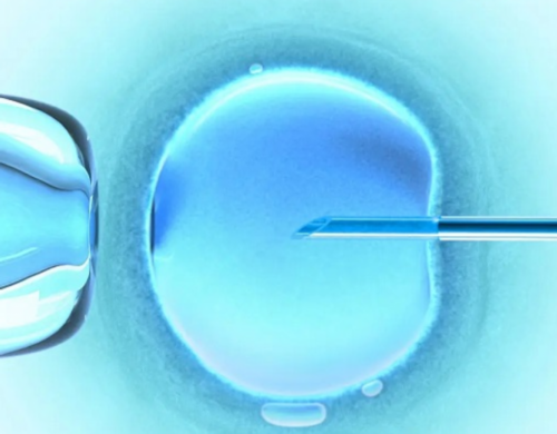 泰安中心试管费用介绍