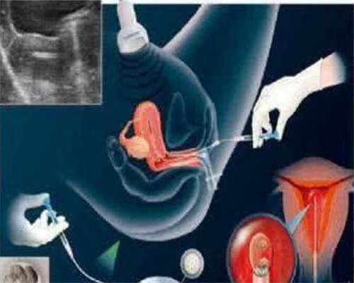 闭经状态做供卵几次成功&举报非法代孕诈骗,备孕不能100%依靠勃锐精，治疗少弱