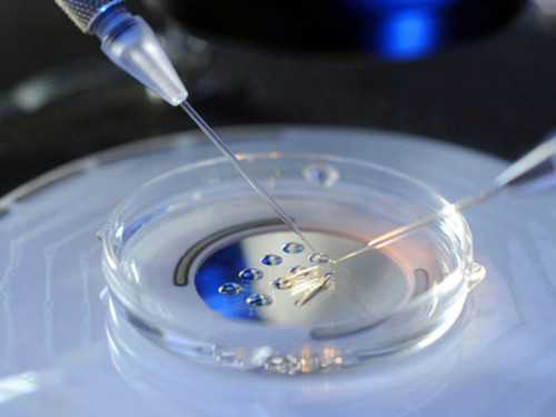 小儿精索鞘膜积液手术后对生育有影响吗?