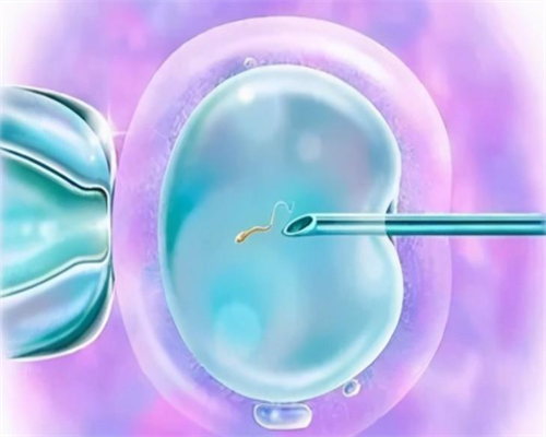 西安代孕公司哪里找,试管婴儿取卵后注意事项有那些，可以上班吗-西安供卵试