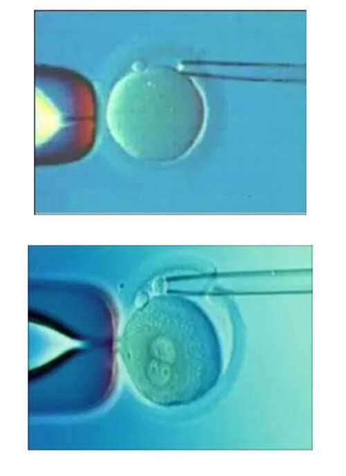 西安代孕靠谱嘛,西安做试管婴儿得多少钱，至少24599元
