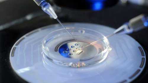 弱精症需要做试管吗&弱精可以做试管吗？,青岛试管医院哪家最好？附青岛试管