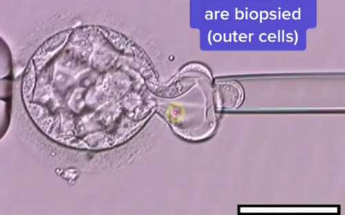 陕西黄热病疫苗接种点,陕西:9-15岁女孩接种疫苗。