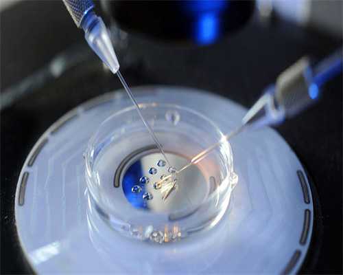 多囊卵巢综合征的病因