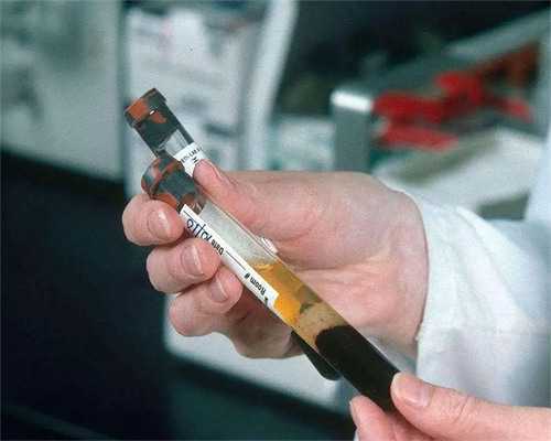 试管婴儿确定性别要多少钱&你们能接受供卵吗,月经期补血吃什么最好