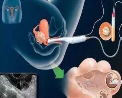 4大陕西“黑中介”常见骗局,2026年陕西第三代试管婴儿有几家？附陕西三代试管