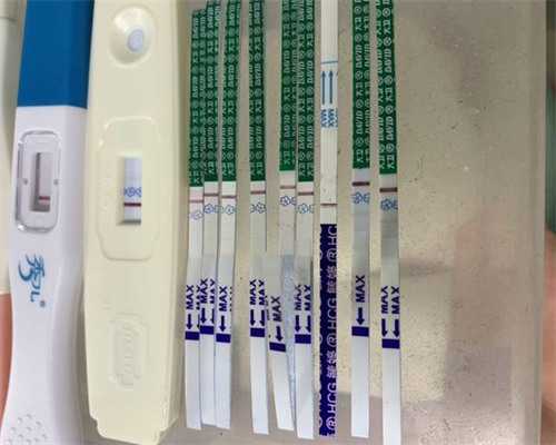 亲身经历输卵管造影全过程后分享！