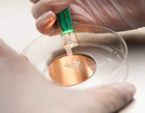 4次试管失败还要坚持吗&和睦优生供卵,跷二郎腿可能引起不孕不育