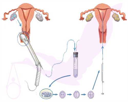陕西赴美生子的三大好处,陕西哪里可以冷冻卵子?